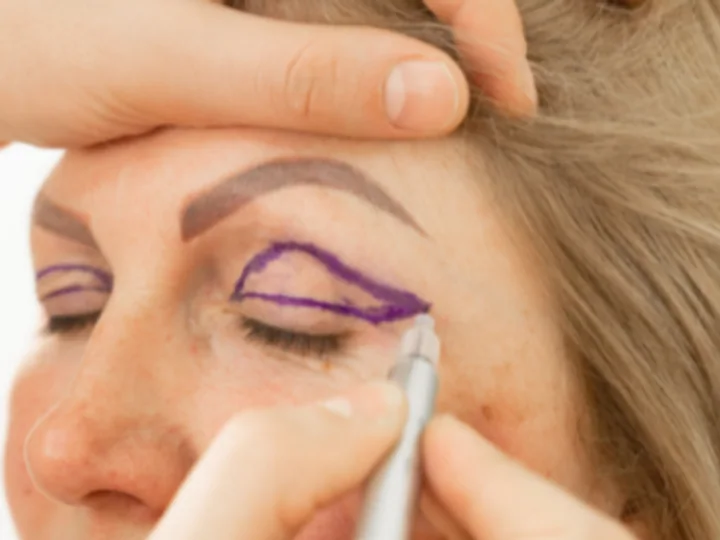 Combien coûte une blépharoplastie en Turquie ?