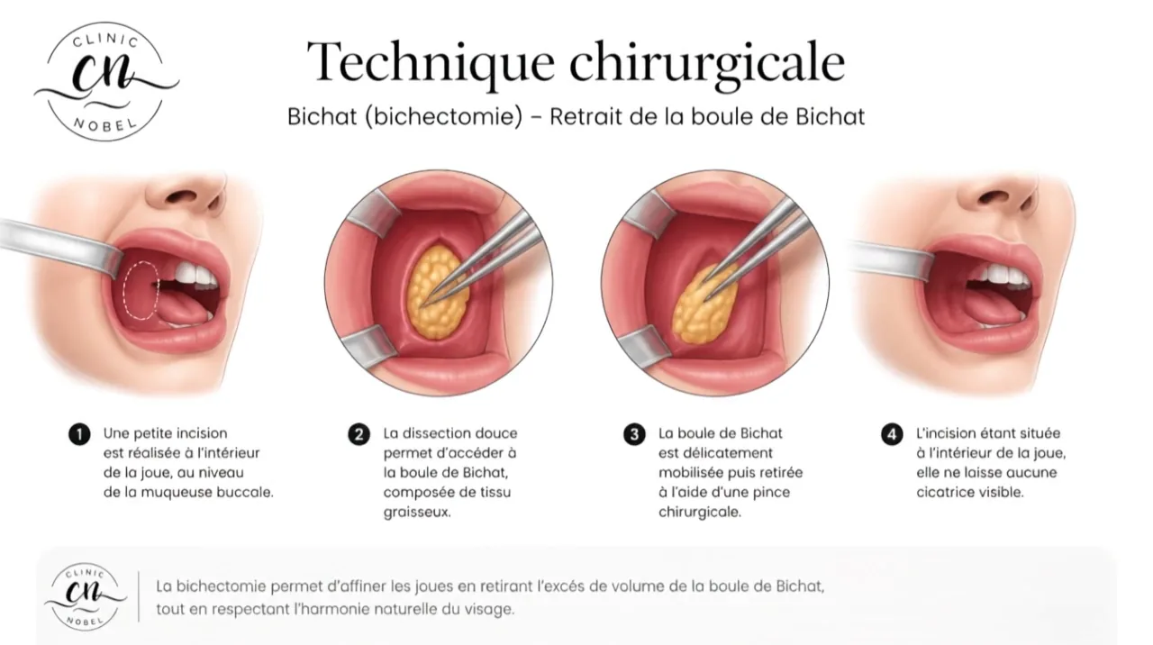 Computergenerierte Illustration: Standbild des Erklärvideos. Dekoratives Bild, weder eine Patientin noch ein Ergebnis.